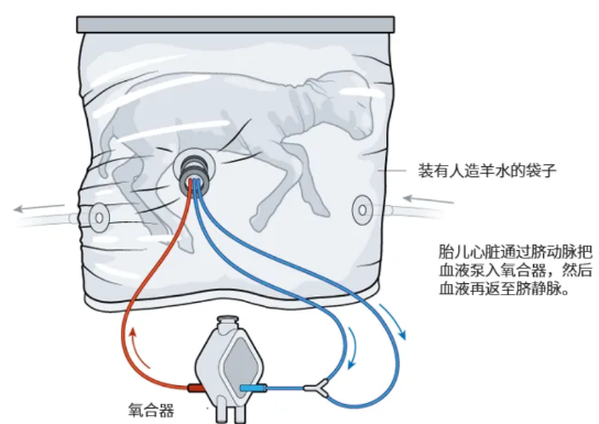 飙上热搜的人造子宫真的能让男人也怀孕？(图6)