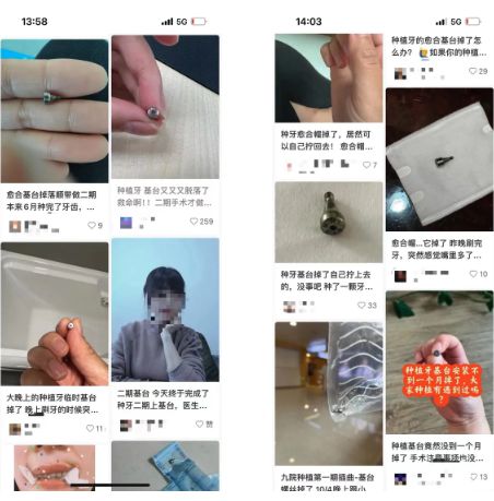 米乐M6网页版：独家｜论：种植牙的“面子”与“里子”(图4)