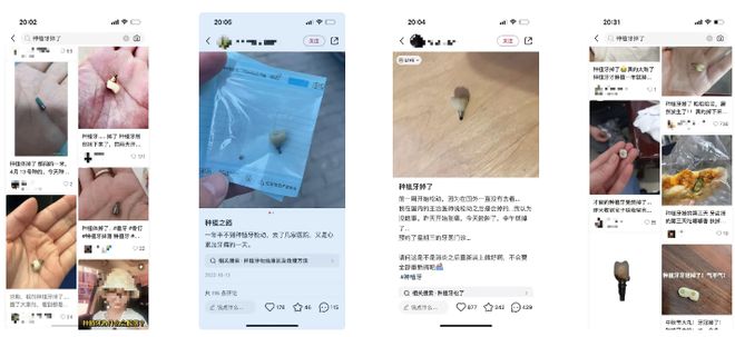 米乐M6网页版：独家｜论：种植牙的“面子”与“里子”(图8)